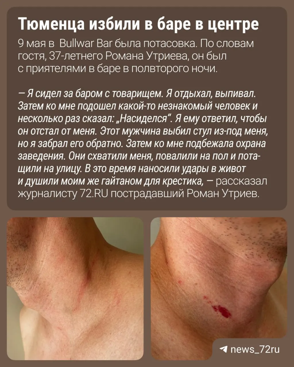 В ночь на 9 мая в одном из баров Тюмени произошёл конфликт: мужчина утверждает, что охрана напала на него и выбросила на улицу. В полиции проводится проверка.