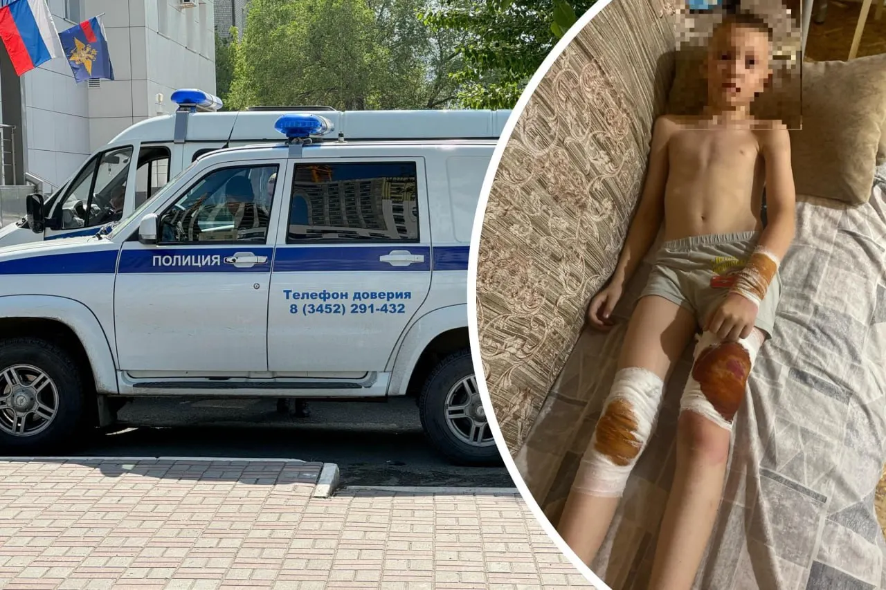 В Тюменской области в СНТ «Локомотив» бойцовская собака напала на ребёнка; по словам матери, хозяева не помогли. По факту инцидента полиция проводит проверку.