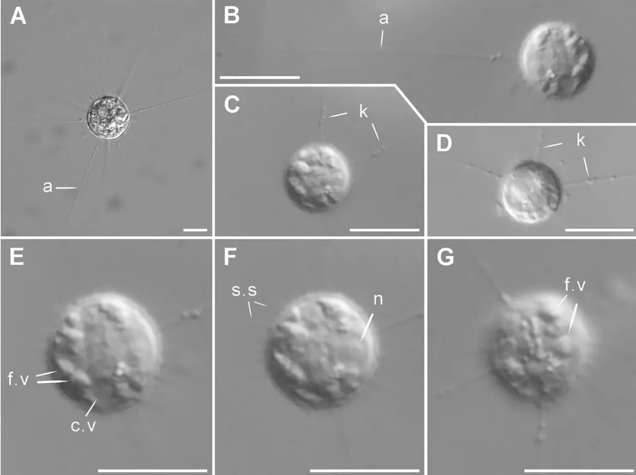Учёные ТюмГУ извлекли из вечной мерзлоты живых протистов Acanthocystis yamallongha — организмы, не вписывающиеся в классические царства жизни. Мерзлотовед из Якутии объясняет, что это может значить для природы и людей.