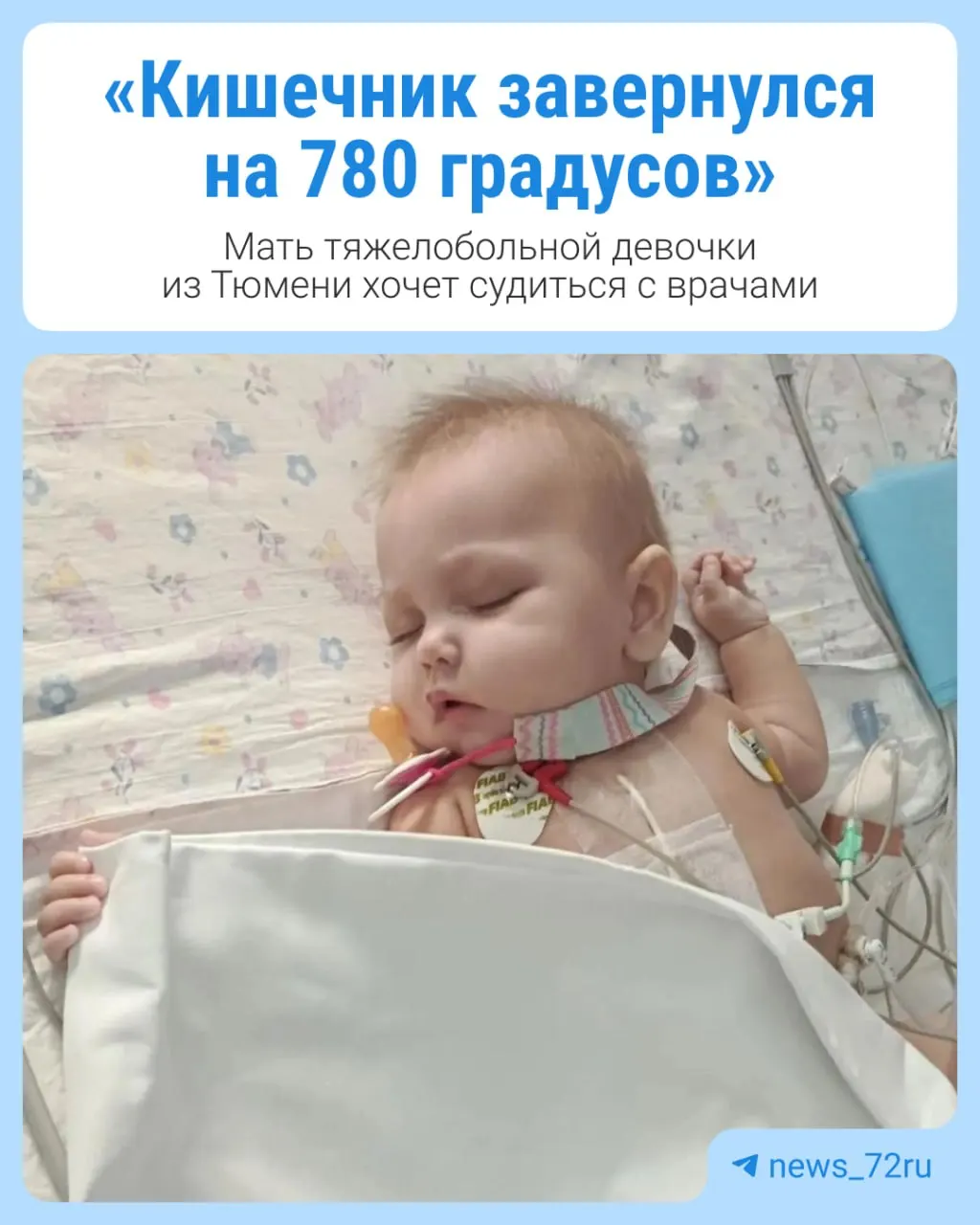 После экстренной операции Варваре Овчинниковой удалили часть тонкого и часть толстой кишки; мать намерена через суд привлечь к ответственности тюменских врачей.